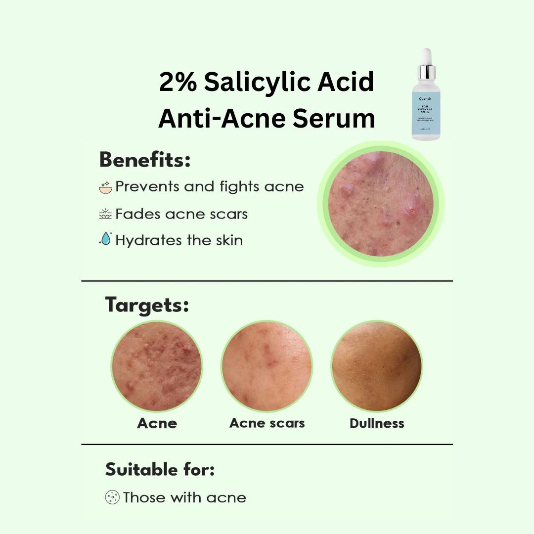 2% Salicylic Acid Anti-Acne Serum