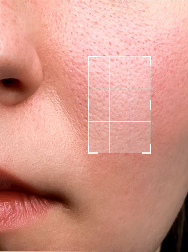 Pore Minimizing Serum